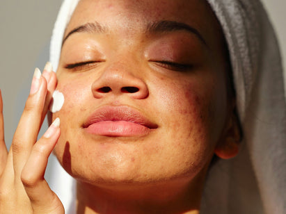 woman applying cream to her face