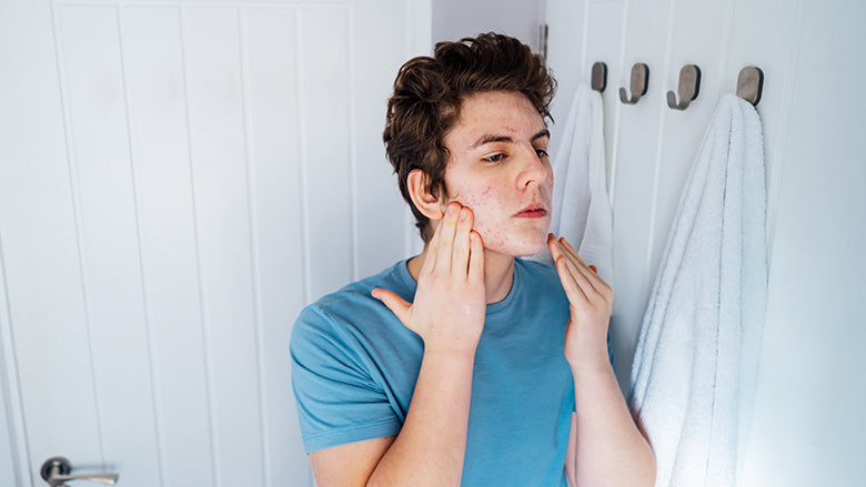 Teenage boy applying skin care